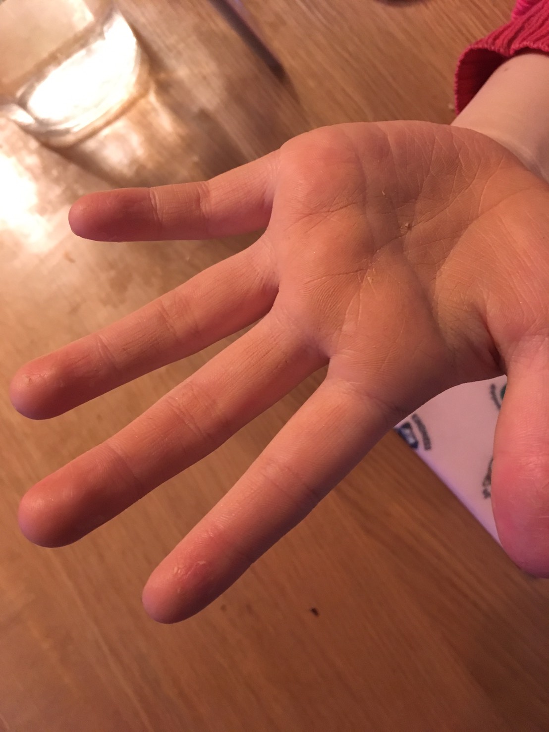 アプリコットオイルで肌荒れがやわらぐ